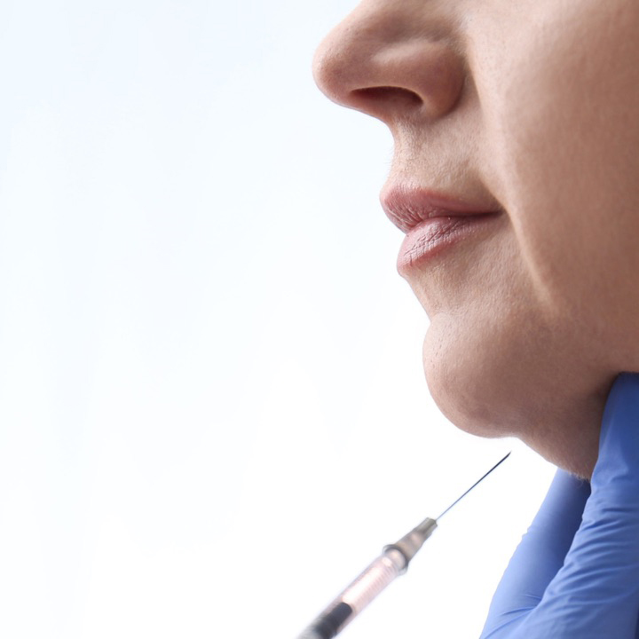 woman receiving Kybella fat dissolving injection under chin