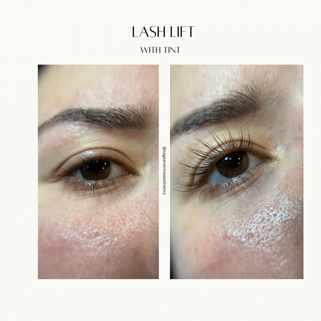 Before and After Image: Lash Lift and Tint - front