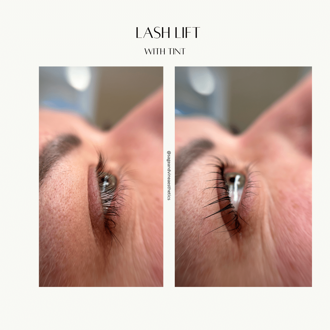 Before and After Image: Lash Lift with Tint - front