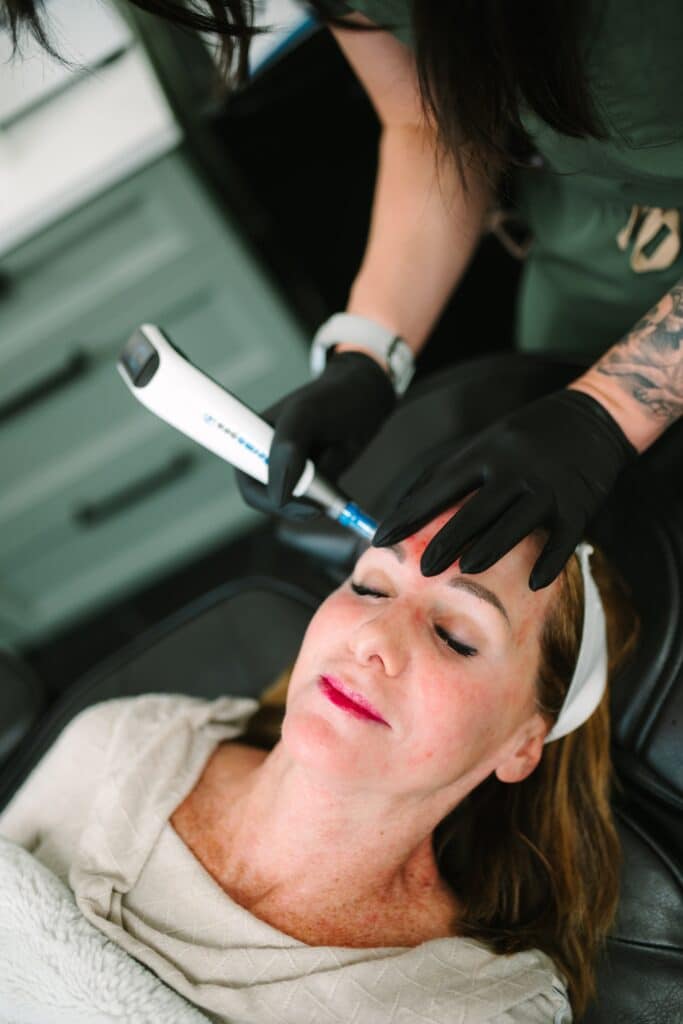 643592_Sage and Vine October 2025 Brand Gloss-114 Top Microneedling Richmond & Mechanicsville VA