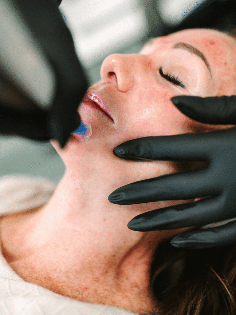 Fillers and Injectables Richmond & Mechanicsville VA