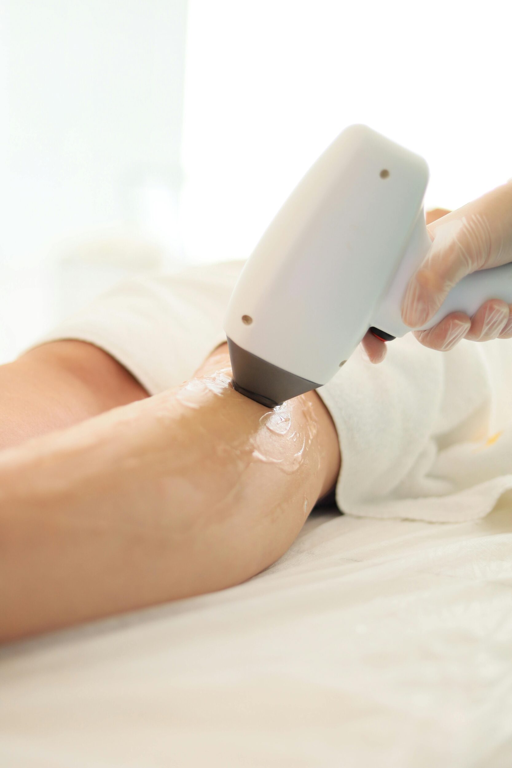 Close-up of laser hair removal being performed on an arm in a spa setting.