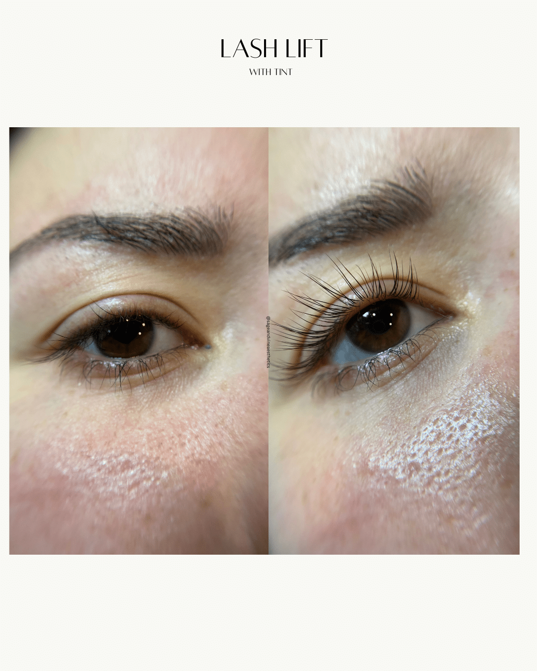 Before and After Image: Lash Lift - front