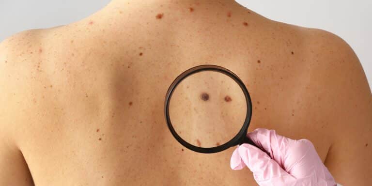 Untitled design (2) Skin Cancer Awareness Month: Why Daily SPF Matters More Than You Think